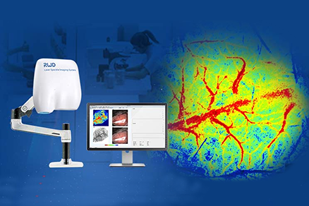 Изображение Лазерная система спекл-визуализации кровотока от RWD Life Science