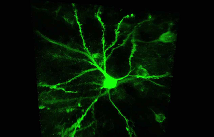 Визуализация нейронных сетей с помощью мультифотонных микроскопов FEMTOSmart
