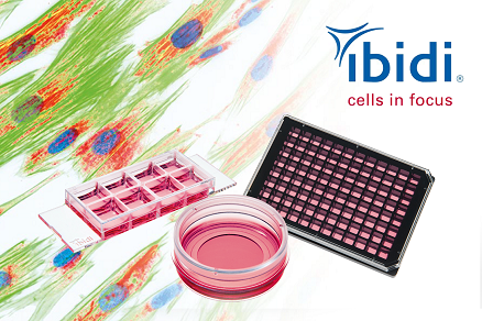 Изображение Лабораторная посуда ibidi: лучшие решения для работы с клетками. Бесплатные образцы!