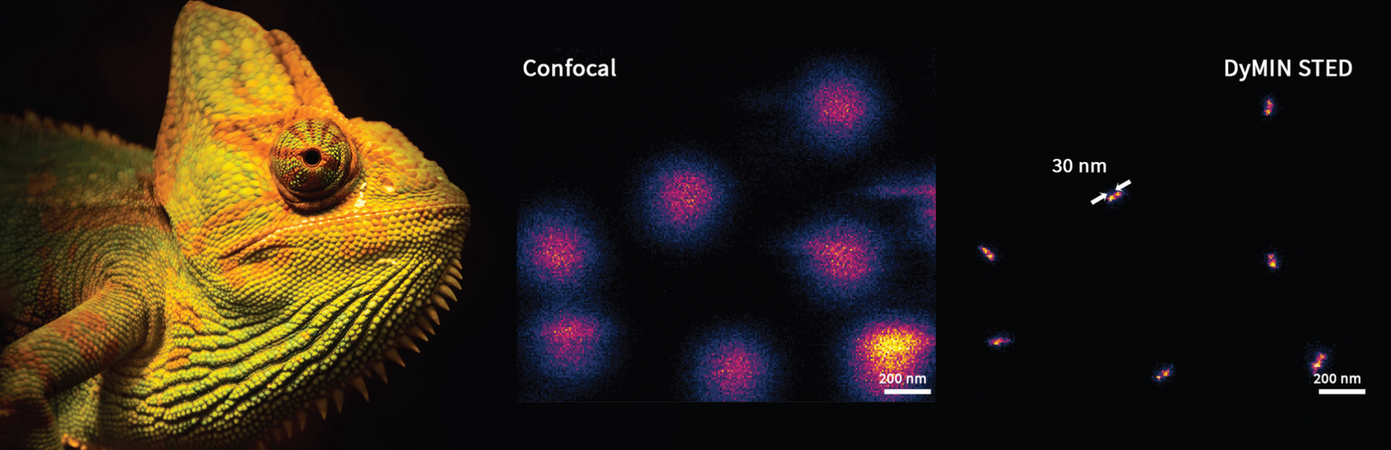 Адаптивное освещение в микроскопии сверхвысокого разрешения: снижение фототоксичности