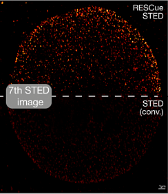 Изображение RESCue STED - метод визуализации со сниженной дозой облучения образца