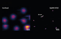 Адаптивное освещение в микроскопии сверхвысокого разрешения: снижение фототоксичности