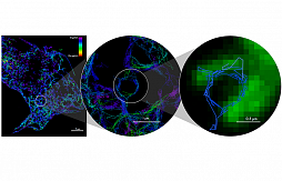 Визуализация мембранных контактов органелл для определения начала болезни в живых клетках